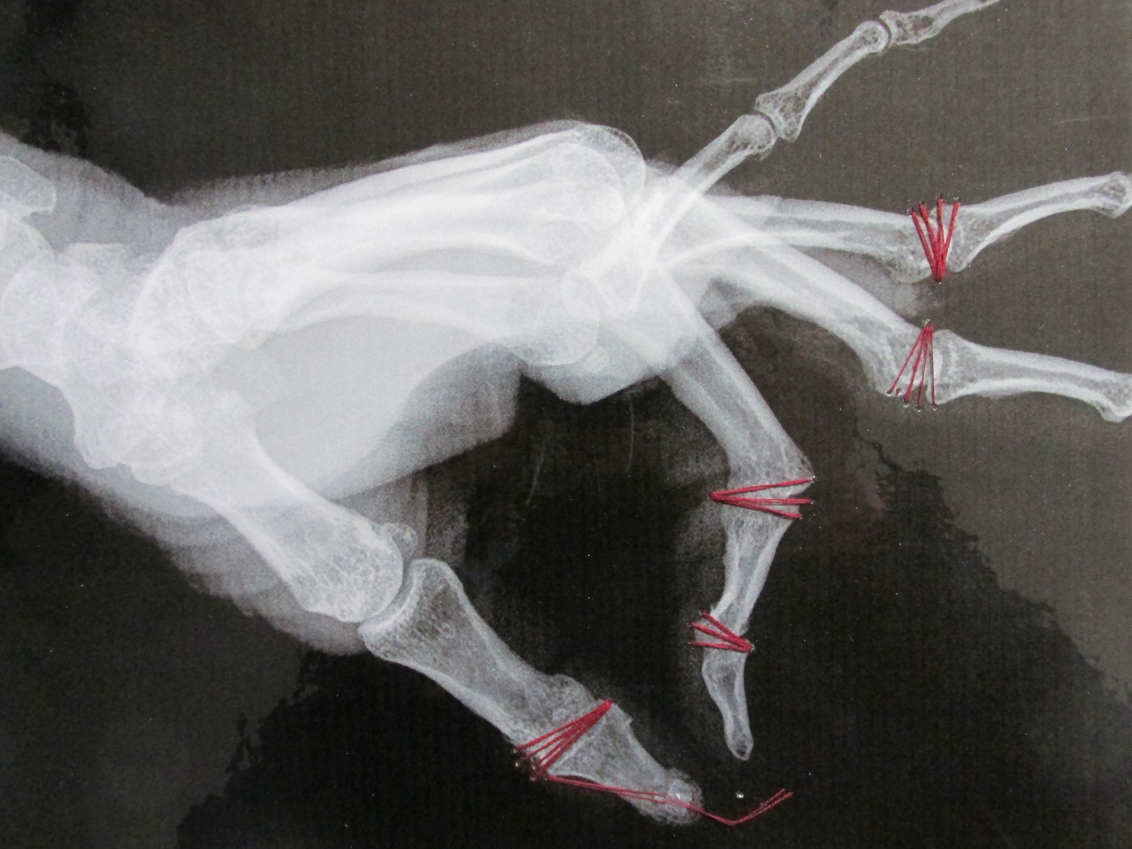 My Stitched Left Hand